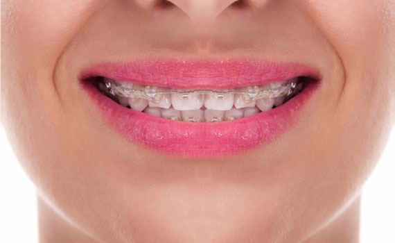smile-1-1