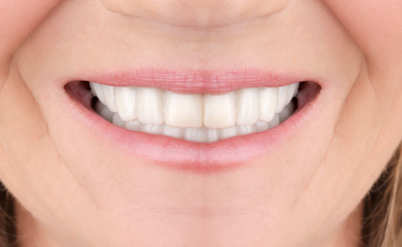 smile-4-2