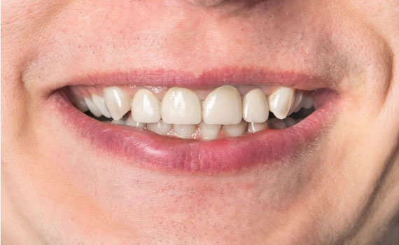 smile-5-2