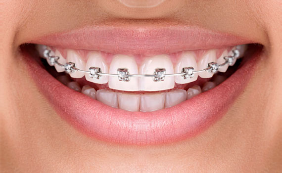 smile-8-1
